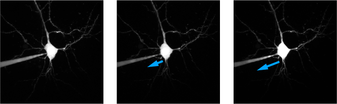 A set of three images, each showing the same layer 5 neuron in an acute brain slice patched with a glass electrode successively drifting away from the cell.